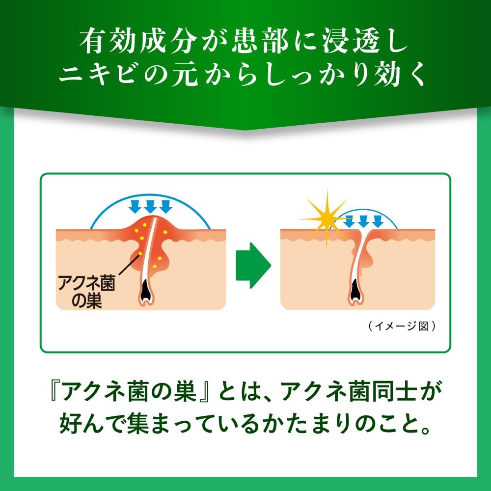樂敦製藥 曼秀雷敦 Acnes25 藥用抗痘噴霧