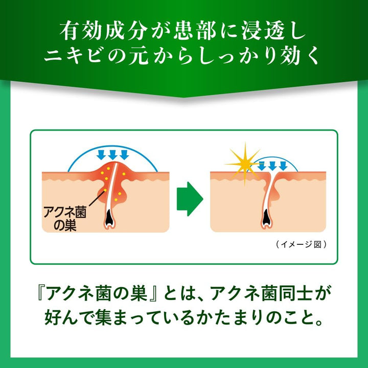 樂敦製藥 曼秀雷敦 Acnes25 藥用抗痘噴霧