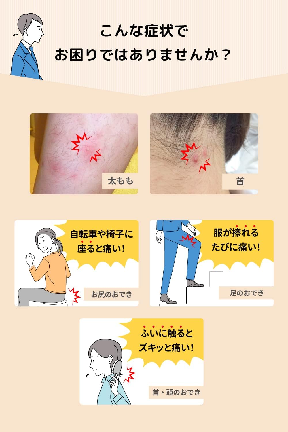 MUHI 池田模範堂 癤子膿包治療藥 EX 12g