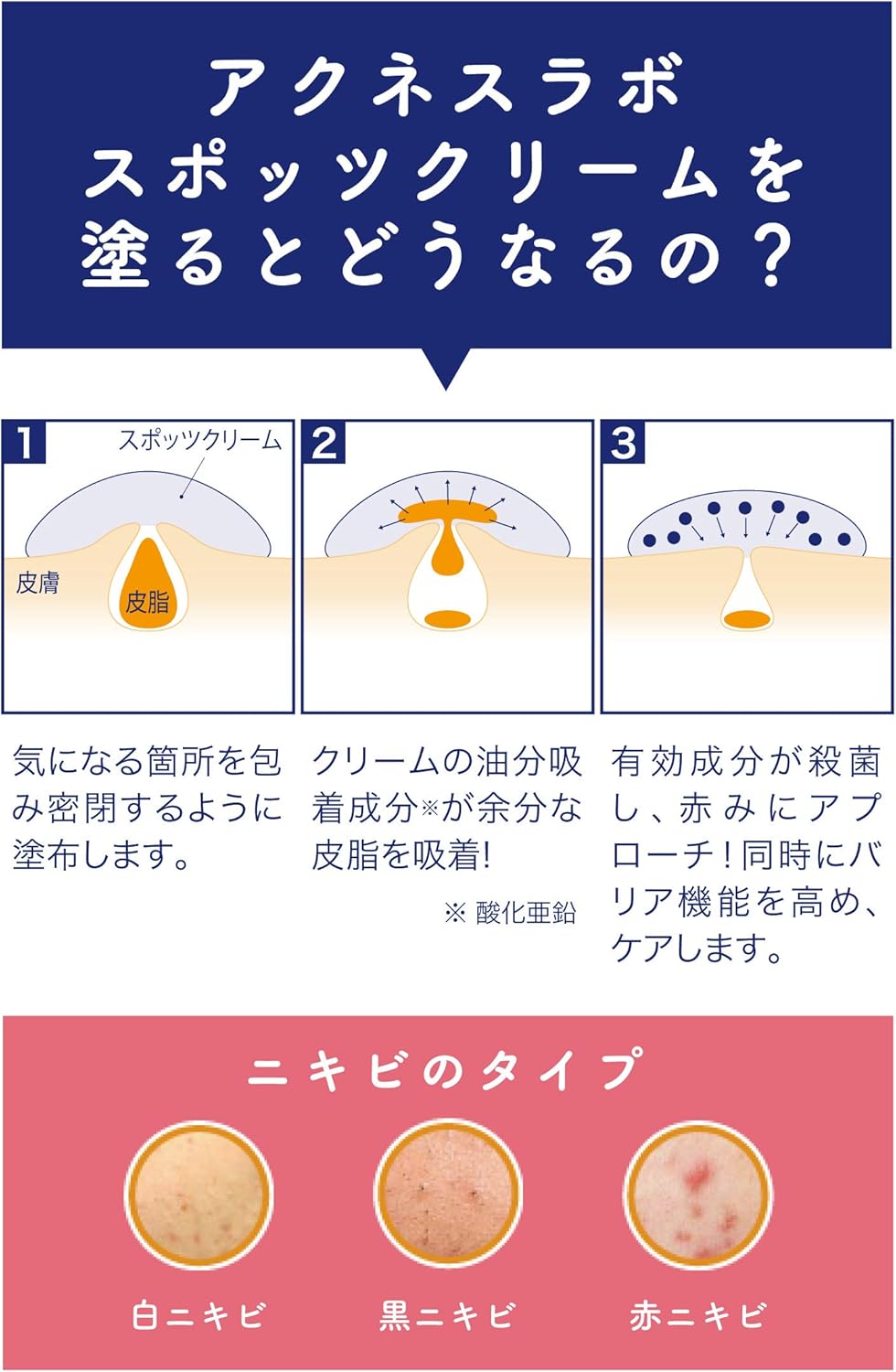 曼秀雷敦 Acnes labo 夜用痘痘藥