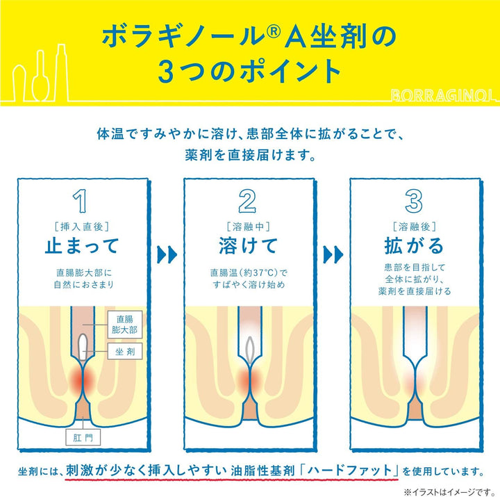 天藤製藥 保能痔 Borraginol A系列 痔瘡栓劑 10個/30個入