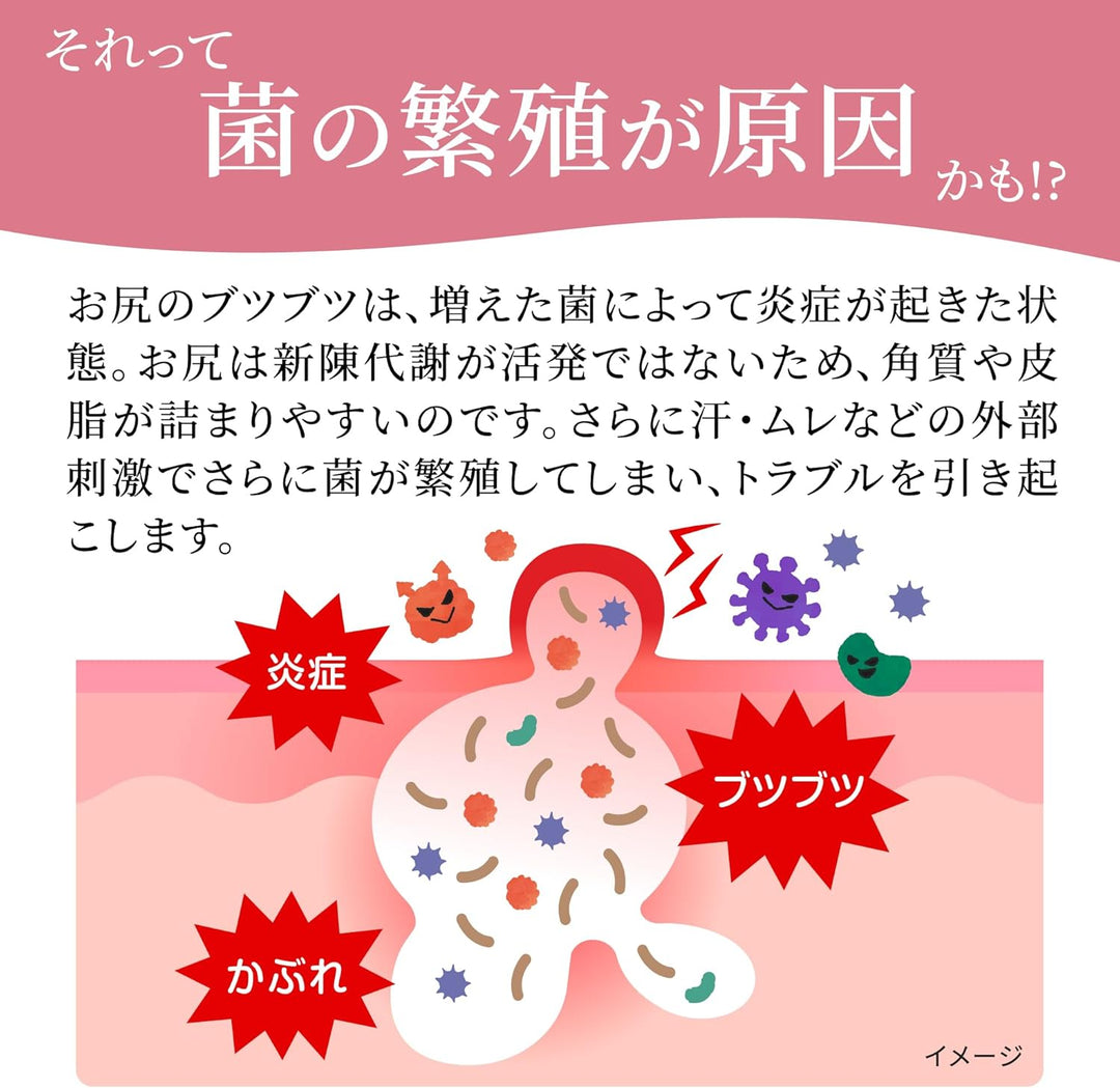 小林製藥 屁屁專用 濕疹粉刺治療軟膏 10g