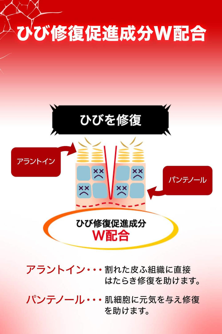 池田模範堂 MUHI 手指龜裂修復軟膏