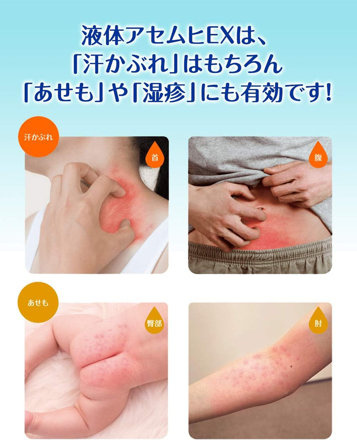 MUHI 池田模範堂 汗疹 EX 治療藥 35ml