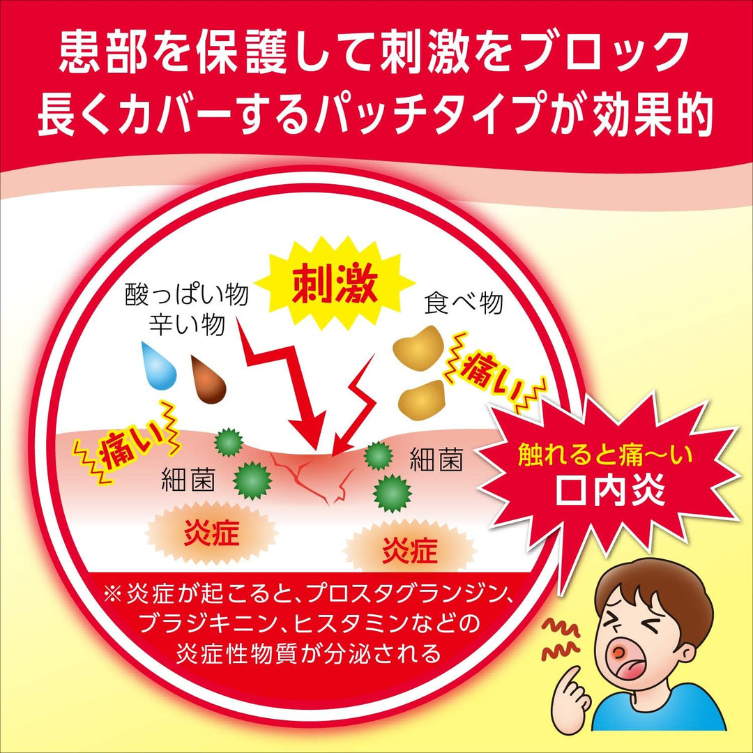 大正製藥 口内炎速效止痛貼片 10枚