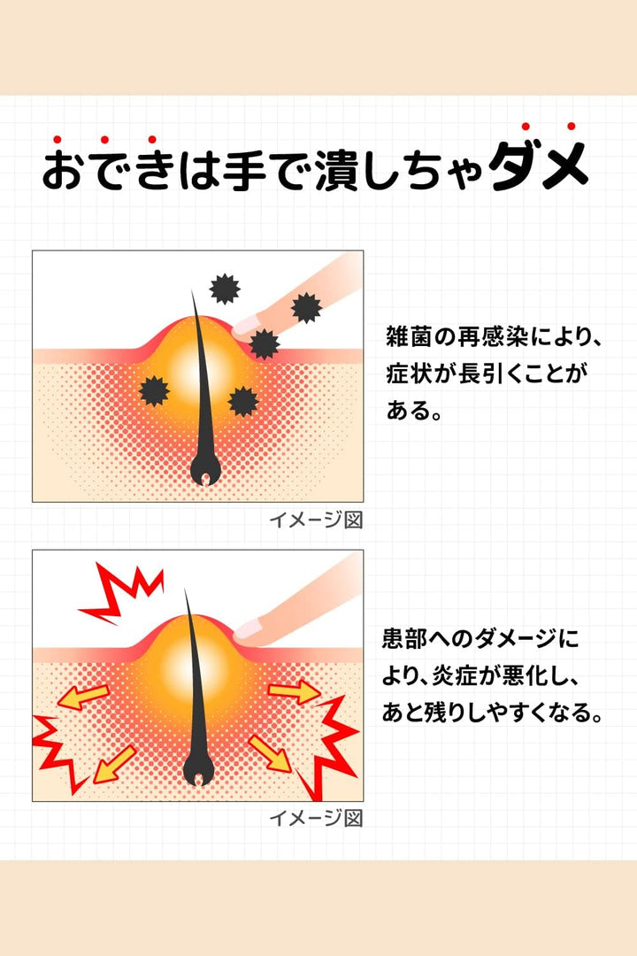 MUHI 池田模範堂 癤子膿包治療藥 EX 12g